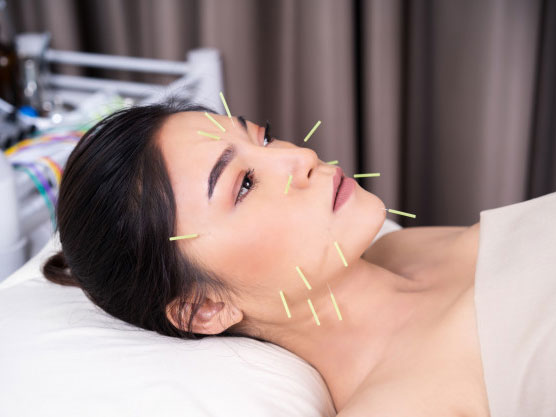 Acupuntura Facial